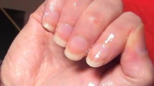 80 - Olivier fingers sucking and nails biting (01 2018)